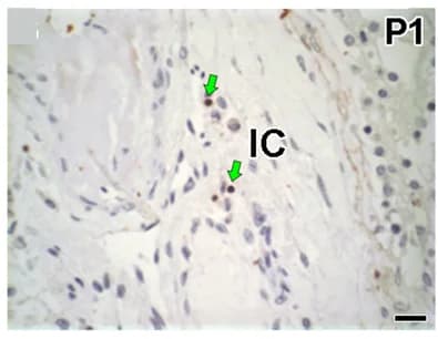 Open access visualization of Microscopy, Neutrophils, MPO Assay, Testis Parenchyma