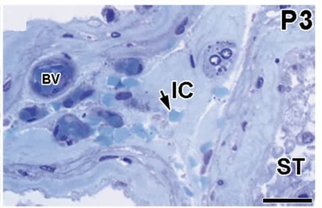 Open access visualization of Microscopy, Immunostaining, Caspase-3, Germ Cells, Testes