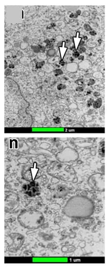Open access visualization of Microscopy, TEM, Electron-dense Vacuoles, Leydig Cells, Cytoplasm