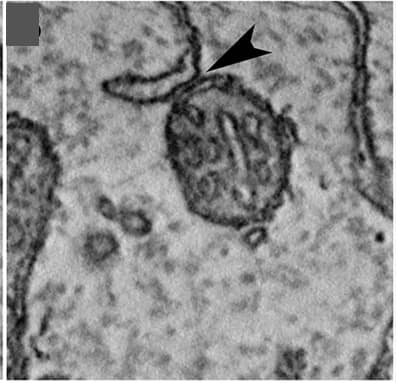 Open access visualization of Microscopy, ER, Mitochondria, MAMs, Electron micrographs