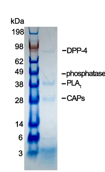 Open access visualization of Gel, SDS-PAGE, Venom Proteins, LC-MS/MS