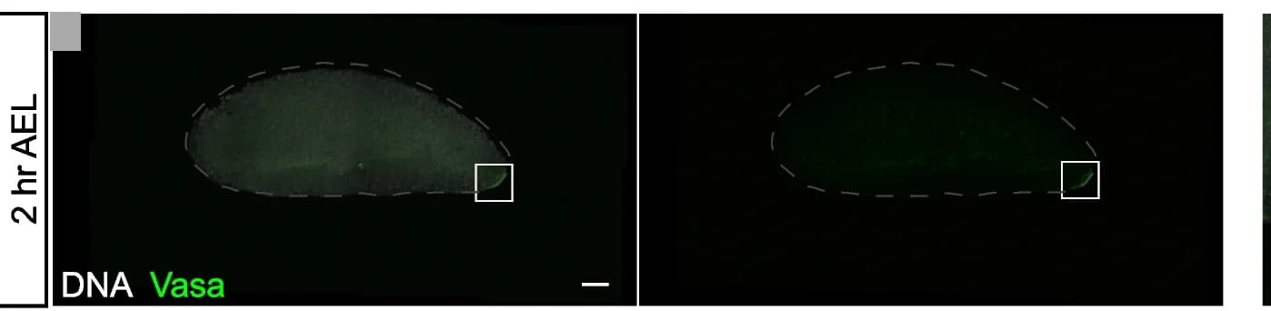Open access visualization of Microscopy, Vasa, Embryo, Posterior End