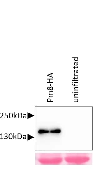 Open access visualization of Gel, Nicotiana benthamiana, Pm8-HA, Anti-HA Western Blot, Ponceau S Staining