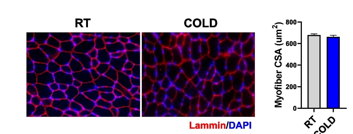 Open access visualization of Bar Plot, Error Bars, Microscopy, Immunofluorescence Staining, Laminin