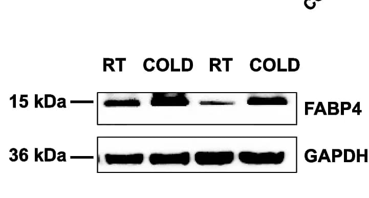Open access visualization of Gel, Western Blot, FABP4, Protein Levels, TA Muscle