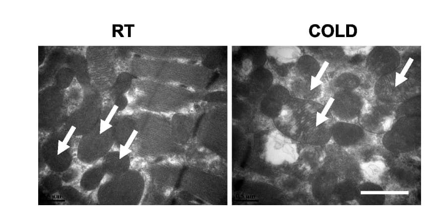 Open access visualization of Microscopy, TEM images, TA muscle, RT mice, COLD mice