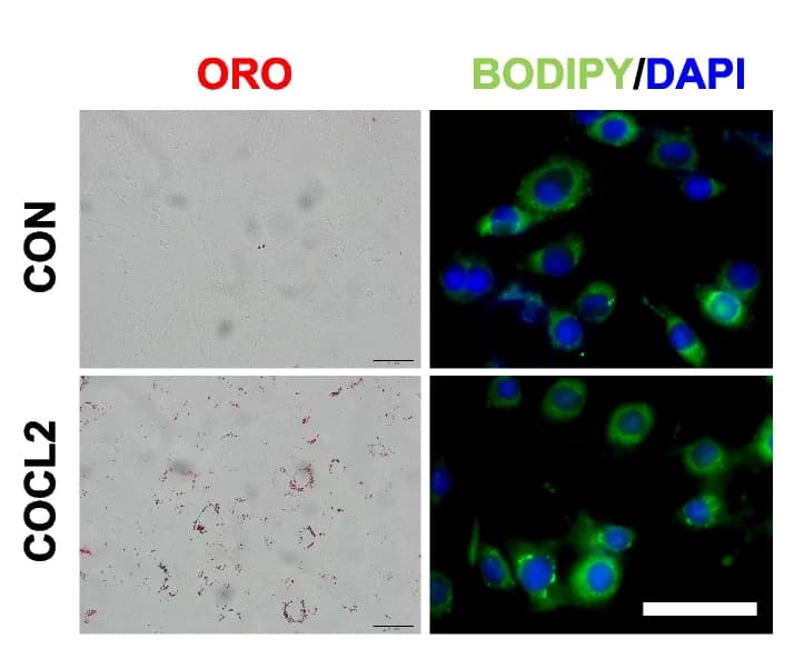 Open access visualization of Microscopy, Oil red O staining, BODIPY staining, Control, COCL2-treated