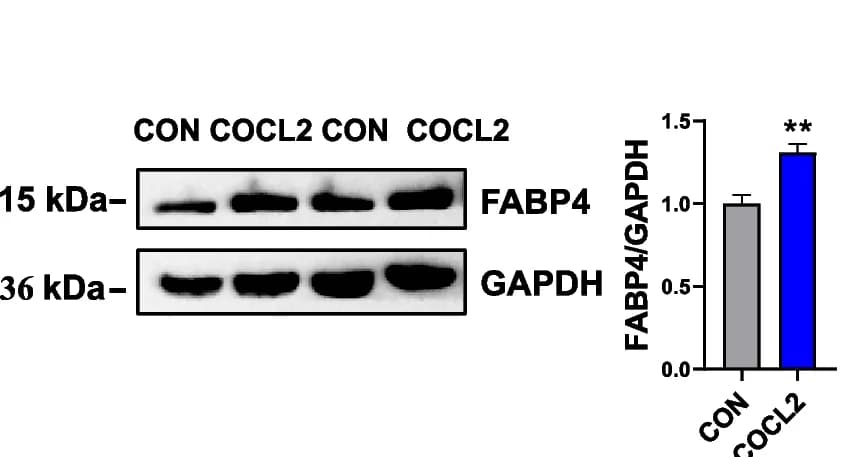 Open access visualization of Bar Plot, Error Bars, Gel, Immunoblot analysis, FABP4 levels