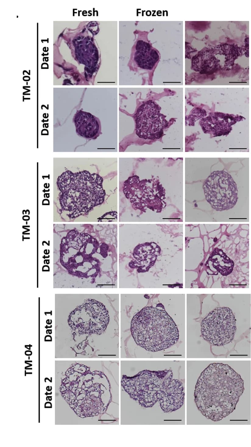 Open access visualization of Microscopy, H&E Staining, Tumoroids, Fresh Tumoroids, Frozen Tumoroids