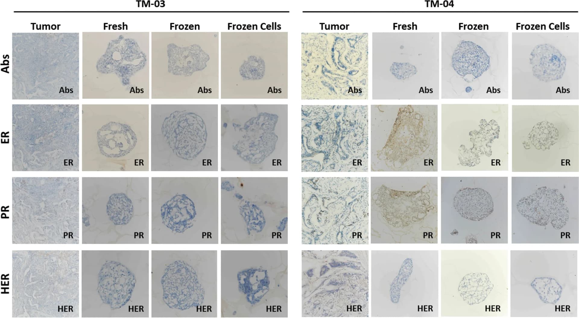 Open access visualization of Microscopy, Breast Cancer, Tumoroids, Histology, Immunohistochemistry