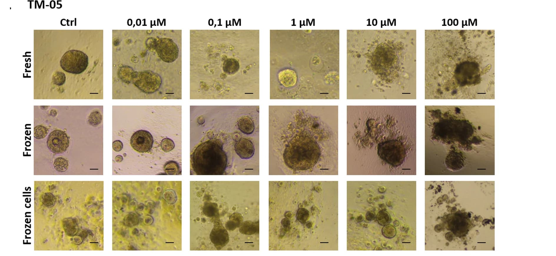 Open access visualization of Microscopy, Photo, Bright Field Images, Tumoroids, Paclitaxel