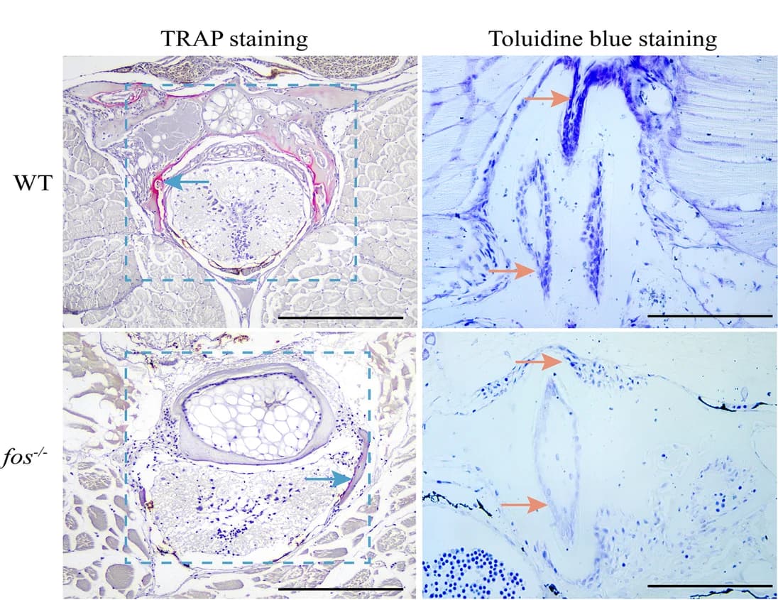 Open access visualization of Microscopy, Trap Staining, Toluidine Blue Staining, Spines, Osteoclasts