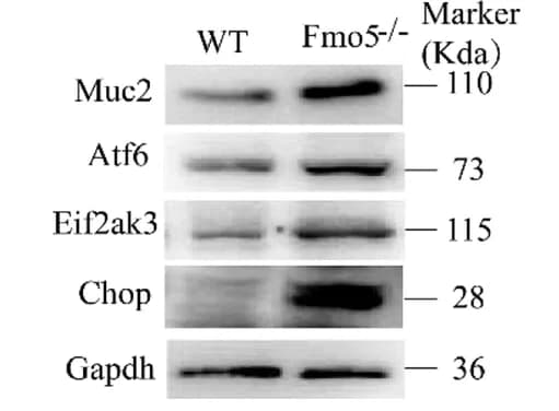 Open access visualization of Gel, Expressions, muc2, Endoplasmic Reticulum Stress, RE Stress