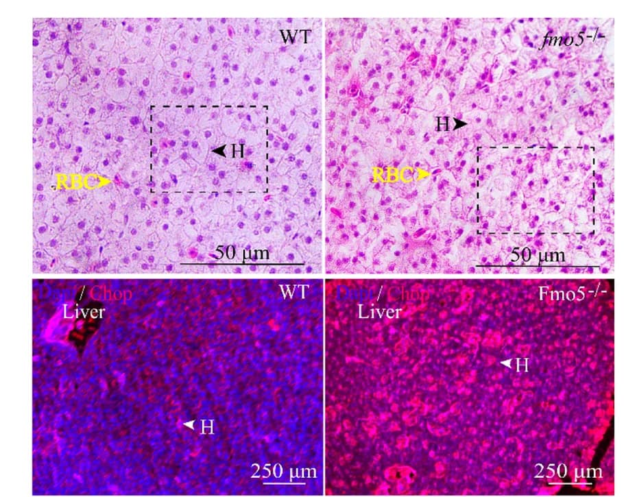 Open access visualization of Microscopy, Histological Structures, Livers, WT, fmo5 deletion