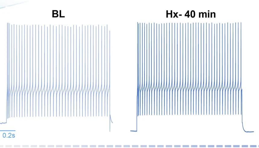 Open access visualization of Line Plot, Line Step, Recordings, Baseline Conditions, Network Output