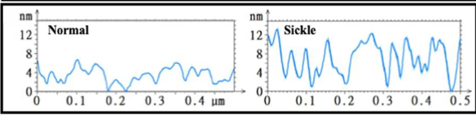 Open access visualization of Line Plot, Cell Cross-sections, Normal Erythrocytes, Sickle Erythrocytes, AFM