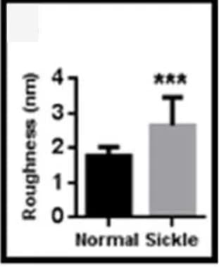 Open access visualization of Bar Plot, Error Bars, Roughness Quantification, AFM, Normal Erythrocytes