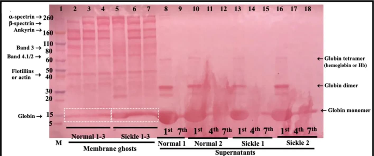 Open access visualization of Gel, Membrane Ghosts, Supernatants, Centrifugation, Normal Erythrocytes