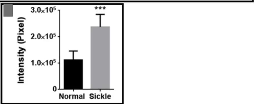 Open access visualization of Bar Plot, Error Bars, Quantitative Analysis, Hemoglobin Bands