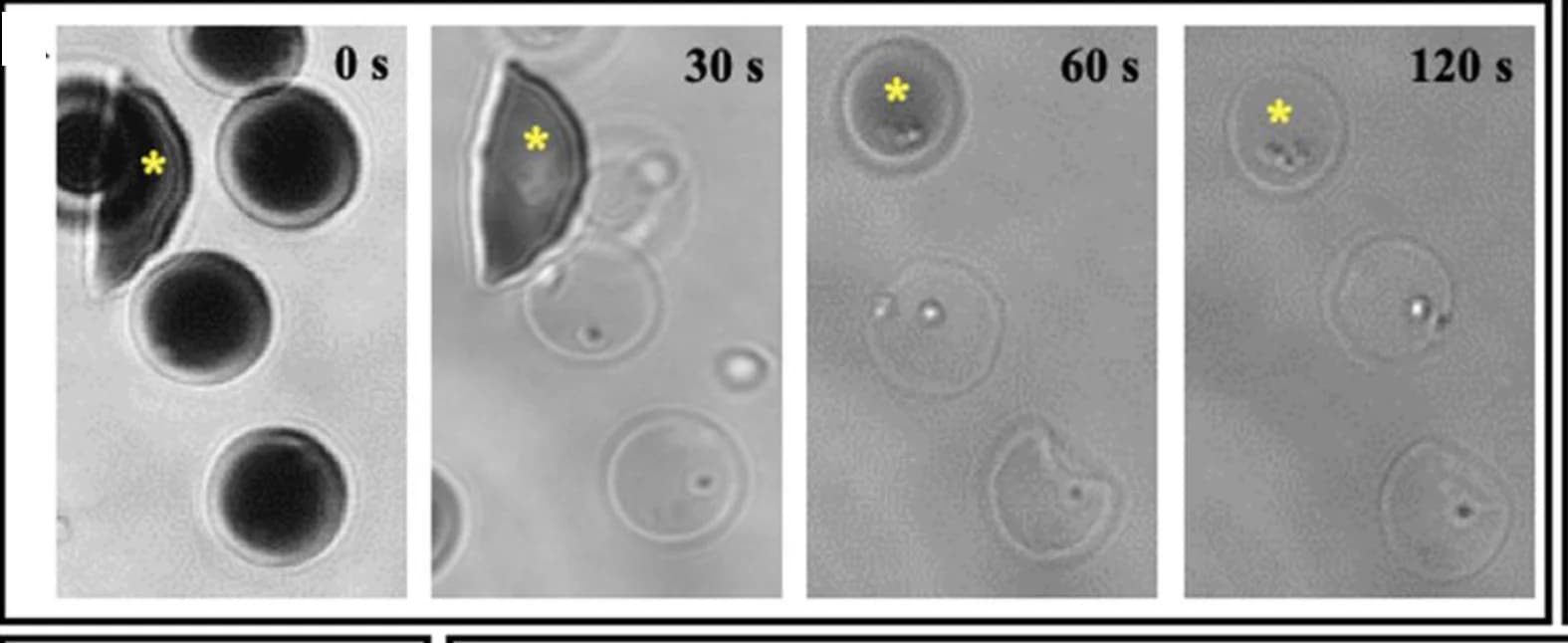 Open access visualization of Microscopy, Optical Microscopy, Cell Transformation, Hypotonic Solution, Sickle Cells