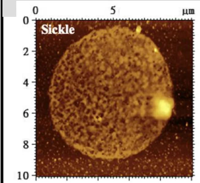 Open access visualization of Microscopy, Membrane Ghost, Erythrocytes, Sickle Cell Anemia