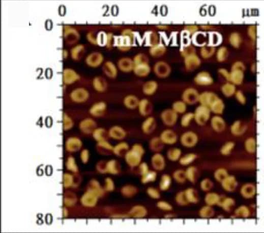 Open access visualization of Microscopy, AFM, Erythrocytes, MβCD, Topographical Images