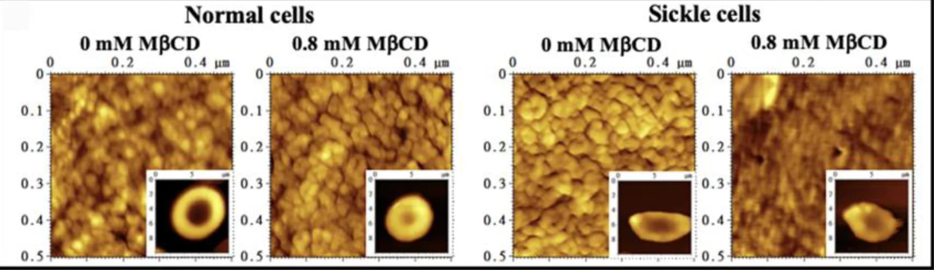 Open access visualization of Microscopy, AFM, Erythrocytes, Sickle Erythrocytes, MβCD