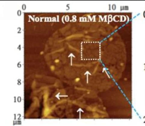 Open access visualization of Microscopy, AFM, Topographical Images, MβCD-treated Ghosts, Normal Erythrocytes