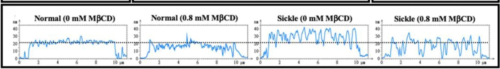 Open access visualization of Line Plot, Height Profiles, Cross Sections, Normal Cells, Sickle Cells