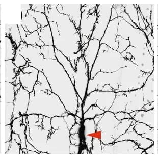 Open access visualization of Microscopy, DdaC neurons, mCD8GFP, Confocal imaging, Scm H3885