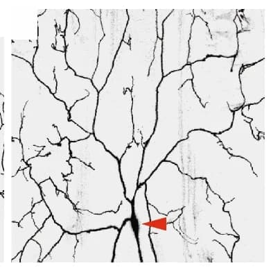 Open access visualization of Microscopy, ddaC Neuron, MARCM clones, Dendrite Pruning