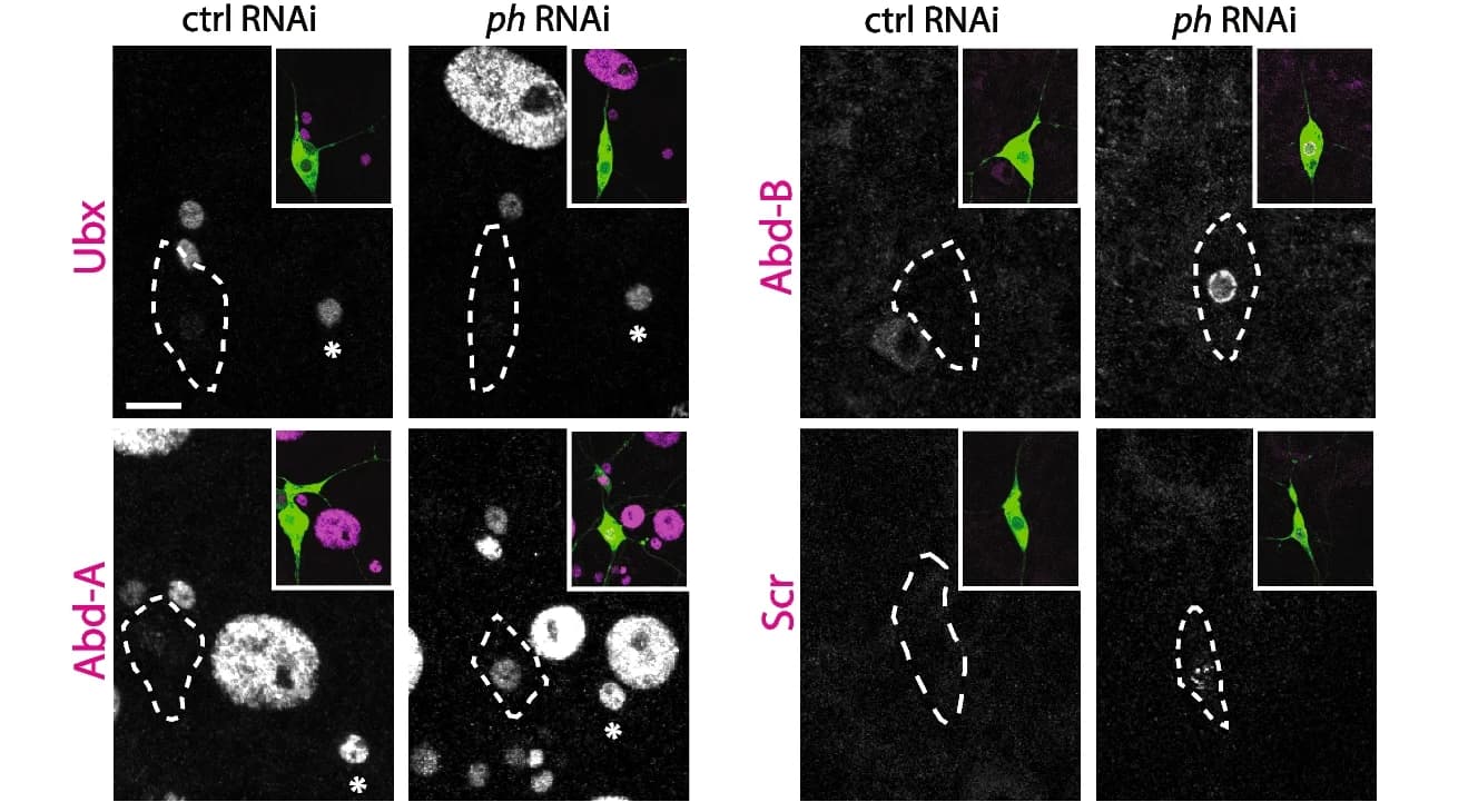 Open access visualization of Microscopy, Confocal Images, ddaC Neurons, Immunostaining, Ubx