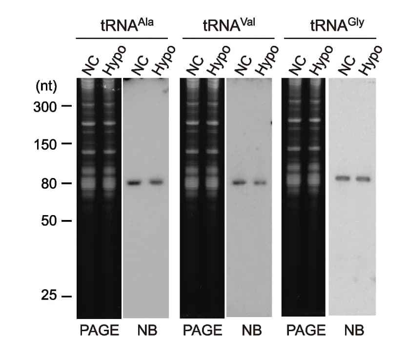 Open access visualization of Gel, Expression Levels, Endo-tRNA, Liver, Northern Blot