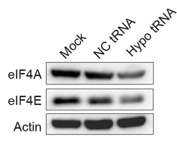 Open access visualization of Gel, Western Blot, eIF4A, eIF4E, GC-2spd Cells
