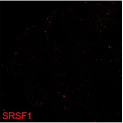 Open access visualization of Microscopy, SRSF1, Oocytes, Primordial Follicle, Immunostaining