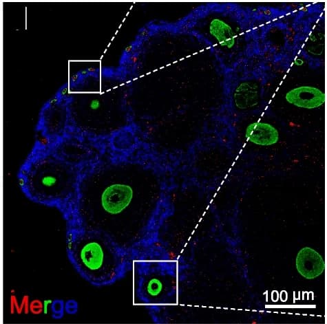 Open access visualization of Microscopy, SRSF1, Oocytes, Primordial Follicle, Immunostaining