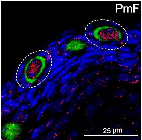Open access visualization of Microscopy, Primordial Follicle, Grown Follicle