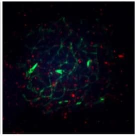 Open access visualization of Microscopy, SRSF1, Oocyte, Meiotic Prophase I, Co-immunostaining