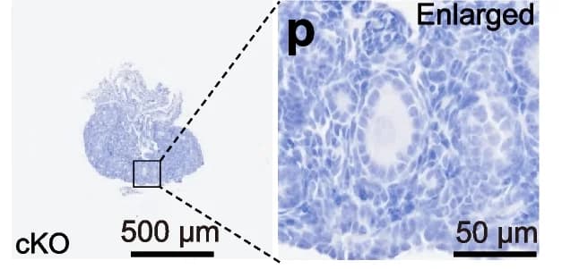Open access visualization of Microscopy, Photo, Ovary Sections, Ctrl Mice, cKO Mice