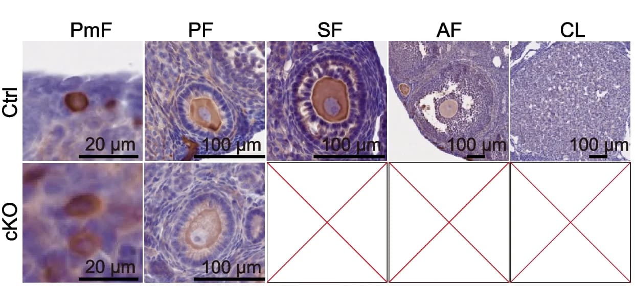 Open access visualization of Microscopy, Photo, Gel, Folliculogenesis, cKO Ovaries