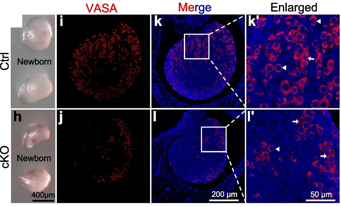 Open access visualization of Microscopy, Photo, Ovarian Atrophy, cKO Mice