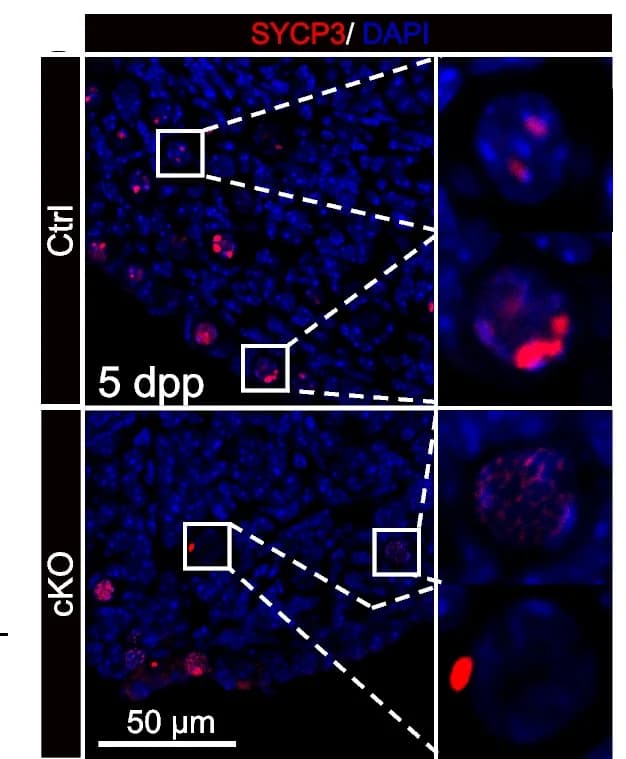 Open access visualization of Microscopy, Immunostaining, SYCP3, Mouse Ovaries, DAPI
