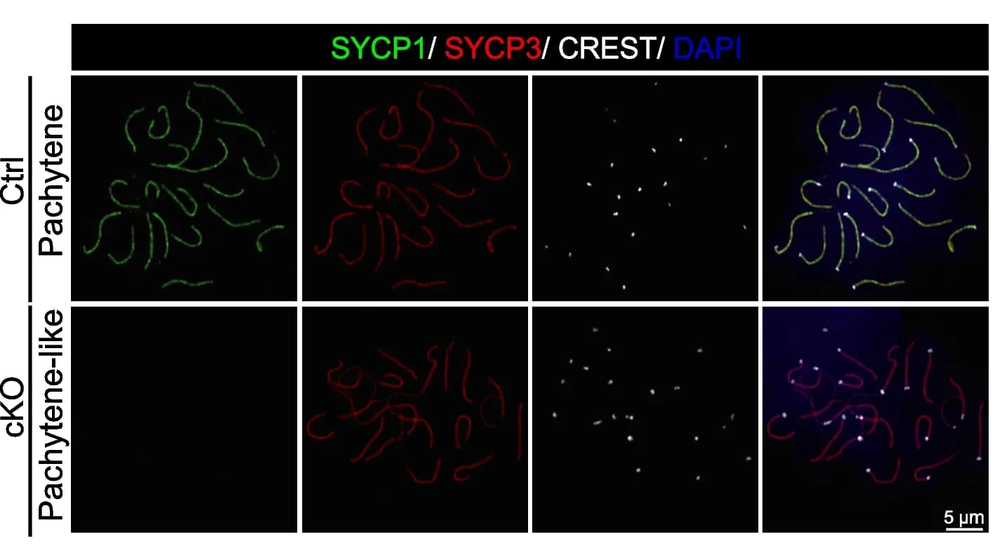 Open access visualization of Microscopy, SYCP1, SYCP3, CREST, Oocytes