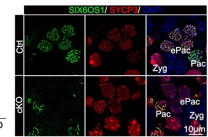 Open access visualization of Microscopy, SIX6OS1, SYCP3, cKO Ovaries, DAPI