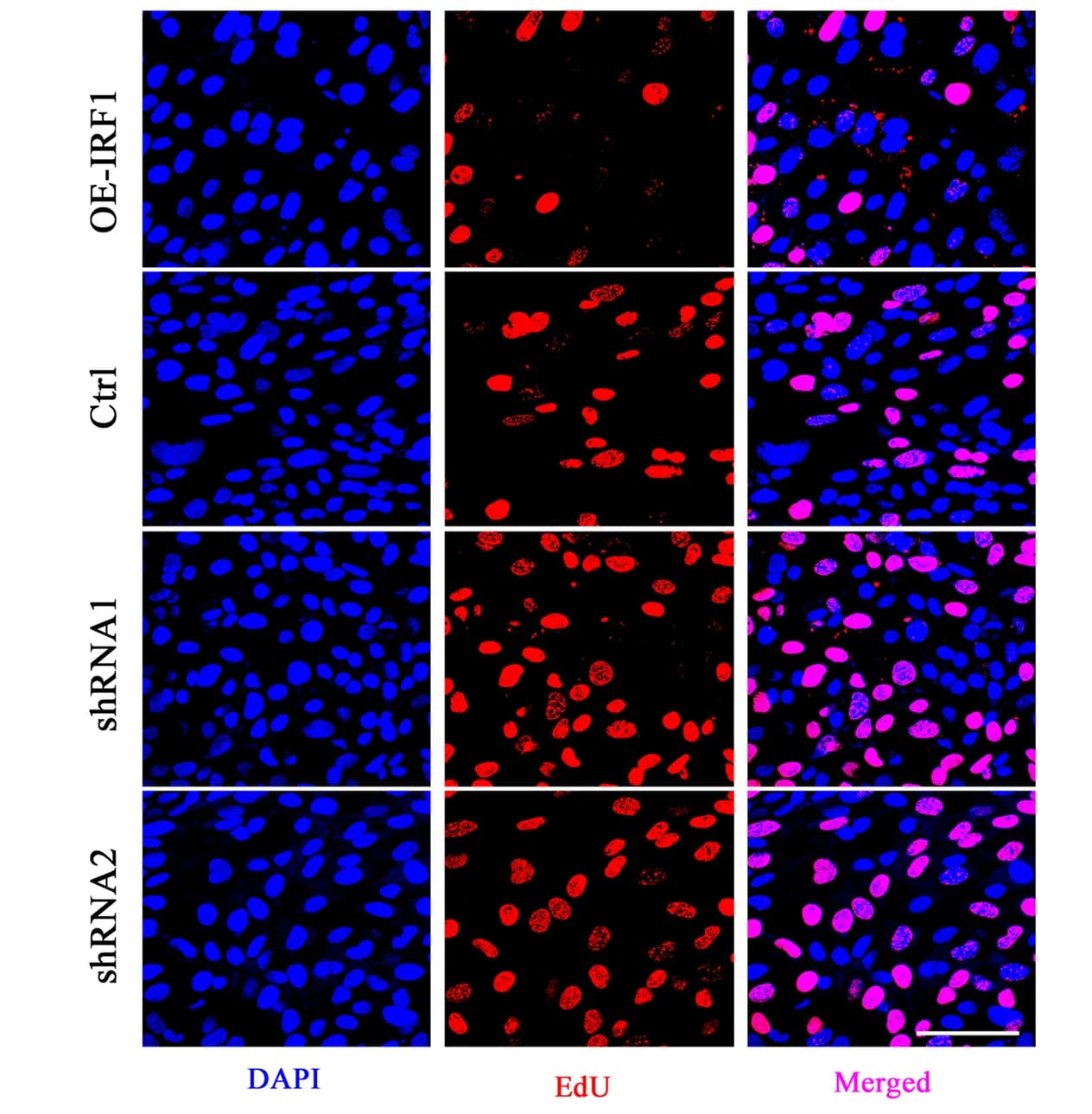 Open access visualization of Microscopy, Confocal Microscopy, EdU Incorporation, Cell Proliferation