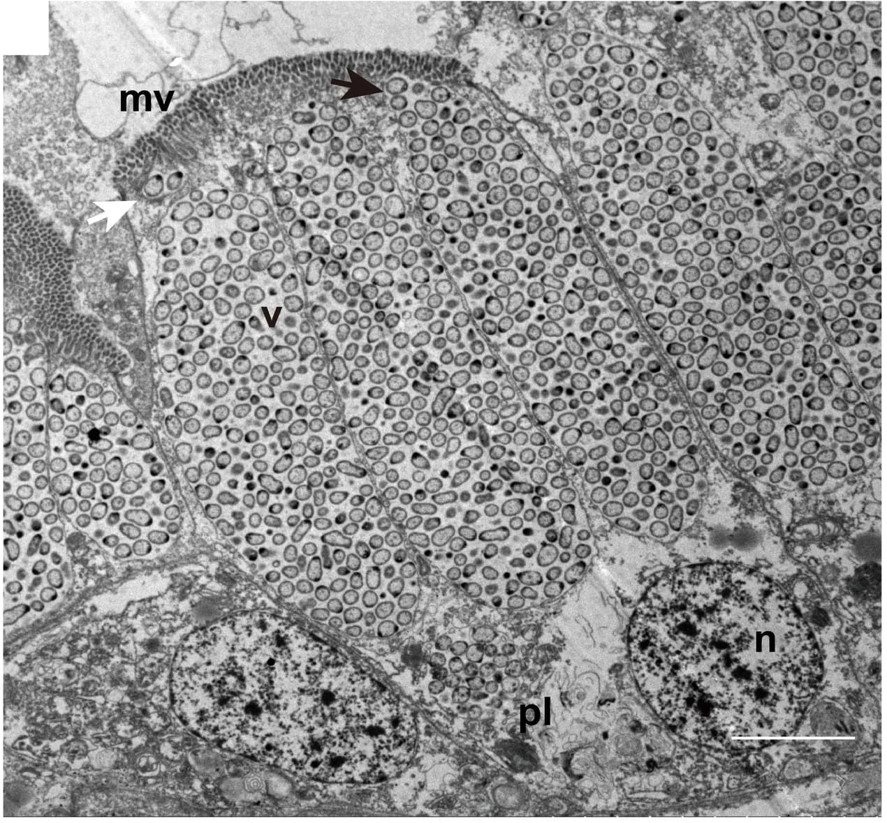 Open access visualization of Microscopy, Transmission Electron Micrography, Bacteriocytes, Gill Filaments, Extracellular Symbionts