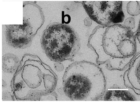 Open access visualization of Microscopy, Lysed Bacterial Symbionts, Phagolysosome-like Organelles, Cell Walls