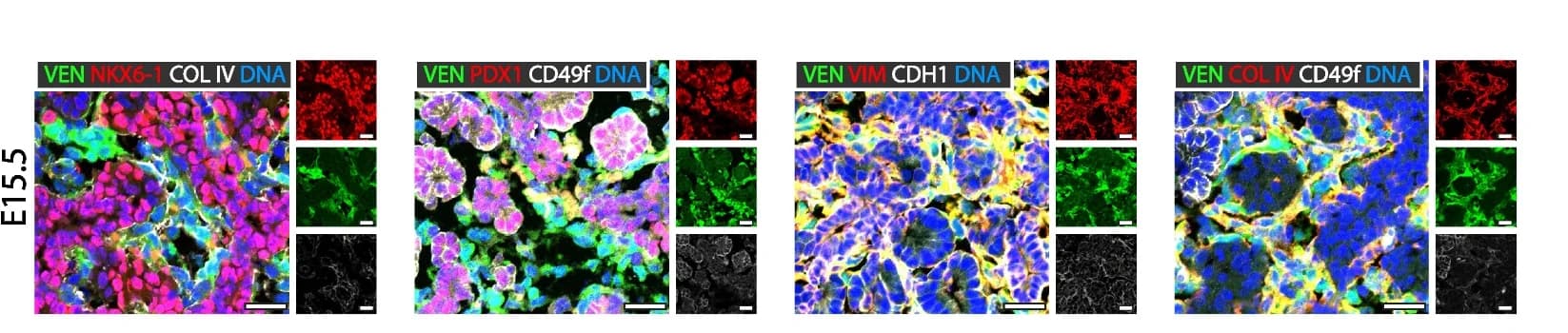 Open access visualization of Microscopy, Immunofluorescence, NKX6-1, COL IV, PDX1