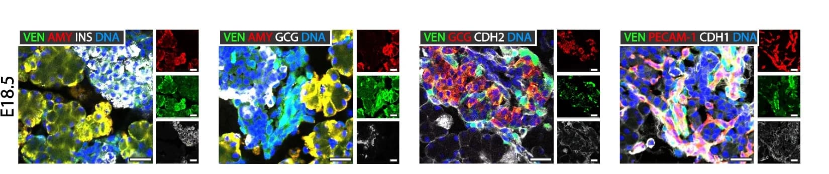 Open access visualization of Microscopy, Immunofluorescence, Pancreatic Amylase, AMY, INS