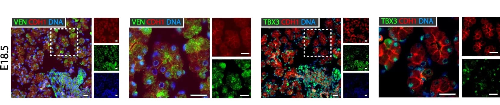 Open access visualization of Microscopy, Immunofluorescence, VEN, TBX3, CDH1